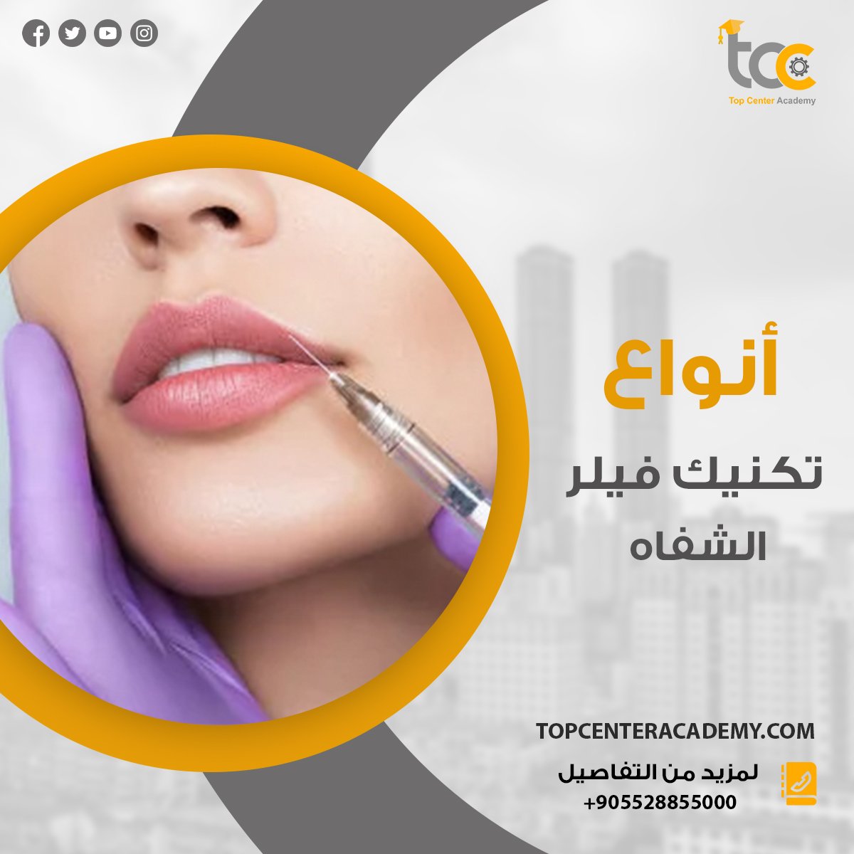 انواع تكنينك فيلر الشفاه