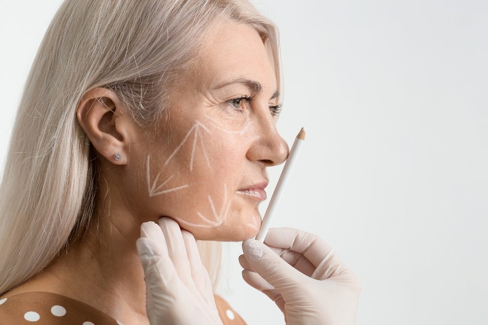 الخيوط التجميلية